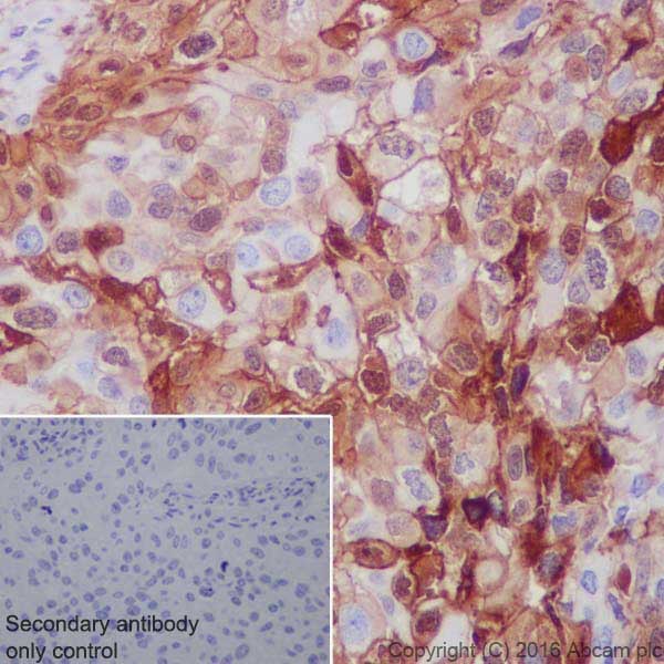 Immunohistochemistry (Formalin/PFA-fixed paraffin-embedded sections) - Anti-Annexin A1/ANXA1 antibody [EPR19342] - BSA and Azide free (ab222398), expandable thumbnail