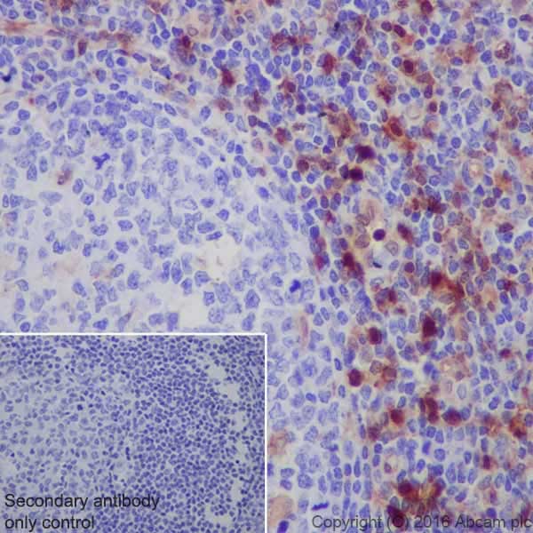 Immunohistochemistry (Formalin/PFA-fixed paraffin-embedded sections) - Anti-Annexin A1/ANXA1 antibody [EPR19342] - BSA and Azide free (AB222398), expandable thumbnail