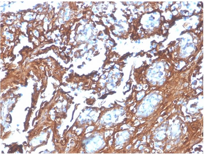 Immunohistochemistry (Formalin/PFA-fixed paraffin-embedded sections) - Anti-Annexin A1/ANXA1 antibody [rANXA1/4310] - BSA and Azide free (AB273143), expandable thumbnail