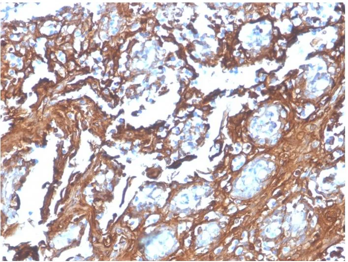 Immunohistochemistry (Formalin/PFA-fixed paraffin-embedded sections) - Anti-Annexin A1/ANXA1 antibody [rANXA1/4310] - BSA and Azide free (AB273143)