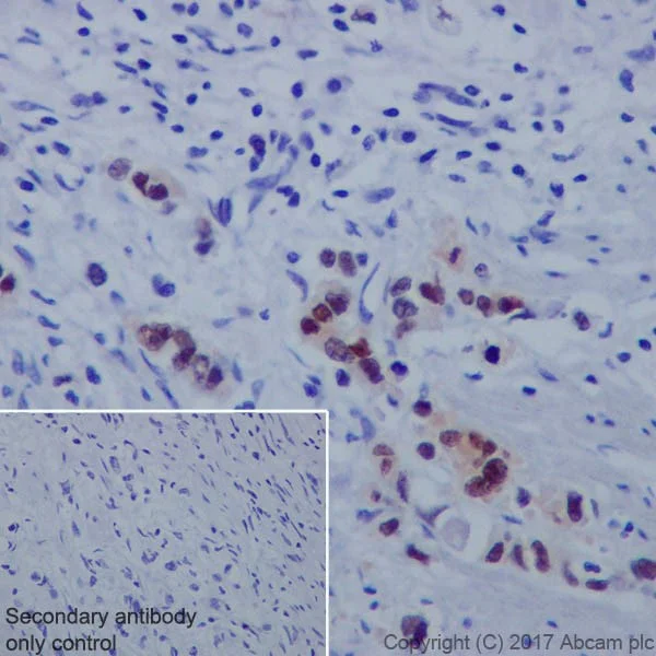 Immunohistochemistry (Formalin/PFA-fixed paraffin-embedded sections) - Anti-Annexin A10/ANXA10 + Annexin-11/ANXA11 antibody [EPR19442] (AB223848)