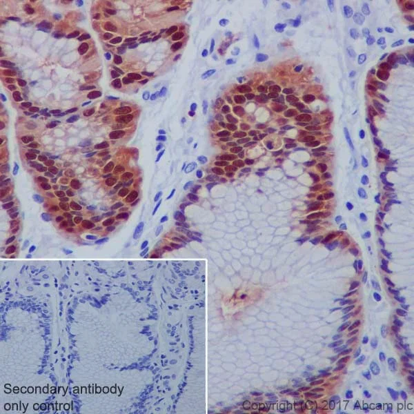 Immunohistochemistry (Formalin/PFA-fixed paraffin-embedded sections) - Anti-Annexin A10/ANXA10 + Annexin-11/ANXA11 antibody [EPR19442] (AB223848)