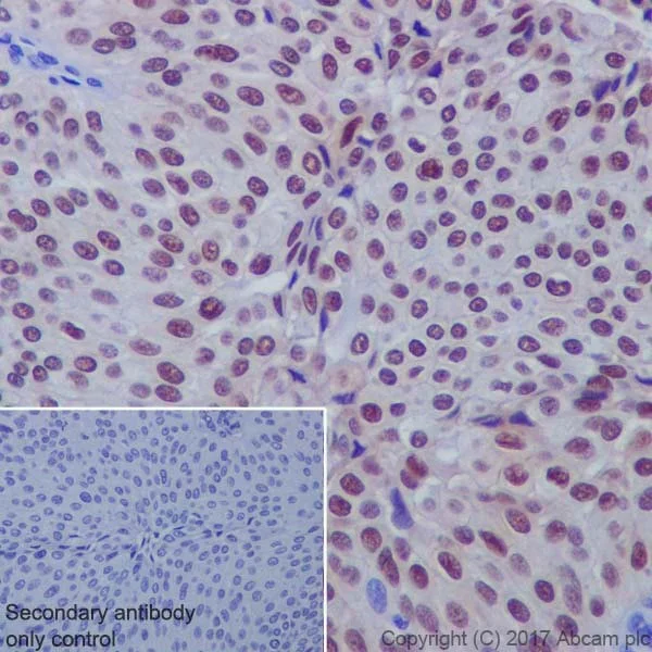 Immunohistochemistry (Formalin/PFA-fixed paraffin-embedded sections) - Anti-Annexin A10/ANXA10 + Annexin-11/ANXA11 antibody [EPR19442] - BSA and Azide free (AB251580)