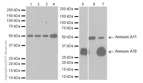 Western blot - Anti-Annexin A10/ANXA10 + Annexin-11/ANXA11 antibody [EPR19442] - BSA and Azide free (AB251580)