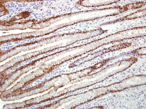Immunohistochemistry (Formalin/PFA-fixed paraffin-embedded sections) - Anti-Annexin A10/ANXA10 antibody (AB227556)