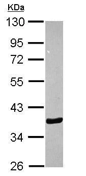 Western blot - Anti-Annexin A10/ANXA10 antibody (AB227556)