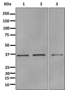 Western blot - Anti-Annexin A10/ANXA10 antibody [EPR13101] (AB180182)