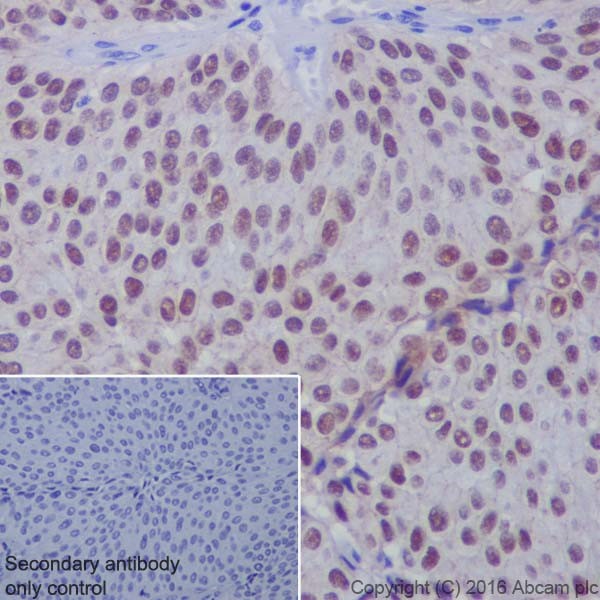 Immunohistochemistry (Formalin/PFA-fixed paraffin-embedded sections) - Anti-Annexin A10/ANXA10 antibody [EPR19507] (AB213656), expandable thumbnail