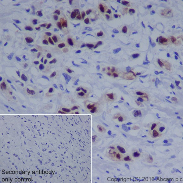 Immunohistochemistry (Formalin/PFA-fixed paraffin-embedded sections) - Anti-Annexin A10/ANXA10 antibody [EPR19507] (AB213656), expandable thumbnail