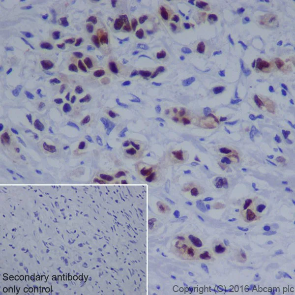 Immunohistochemistry (Formalin/PFA-fixed paraffin-embedded sections) - Anti-Annexin A10/ANXA10 antibody [EPR19507] (AB213656)