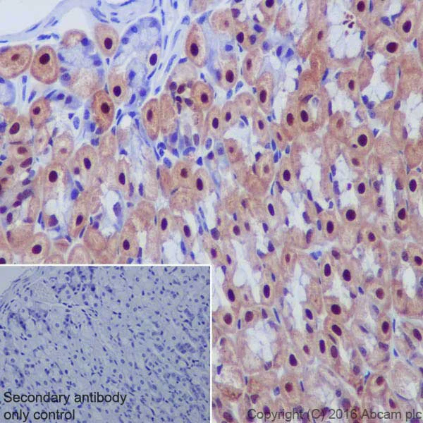 Immunohistochemistry (Formalin/PFA-fixed paraffin-embedded sections) - Anti-Annexin A10/ANXA10 antibody [EPR19507] (AB213656)