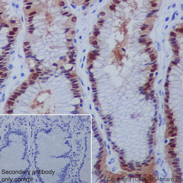 Immunohistochemistry (Formalin/PFA-fixed paraffin-embedded sections) - Anti-Annexin A10/ANXA10 antibody [EPR19507] (AB213656), expandable thumbnail