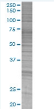 Annexin A10 overexpression 293T lysate (whole cell)