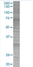 SDS-PAGE - Annexin A10 overexpression 293T lysate (whole cell) (AB94215)