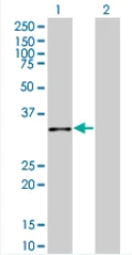 Western blot - Annexin A10 overexpression 293T lysate (whole cell) (AB94215)