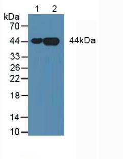 Western blot - Anti-Annexin A3/ANXA3 antibody [6#] (AB239582)