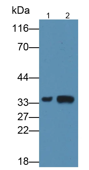Western blot - Anti-Annexin A3/ANXA3 antibody [6#] (AB239582)