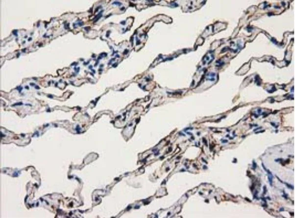 Immunohistochemistry (Formalin/PFA-fixed paraffin-embedded sections) - Anti-Annexin A3/ANXA3 antibody [OTI5G4] - BSA and Azide free (AB273649)