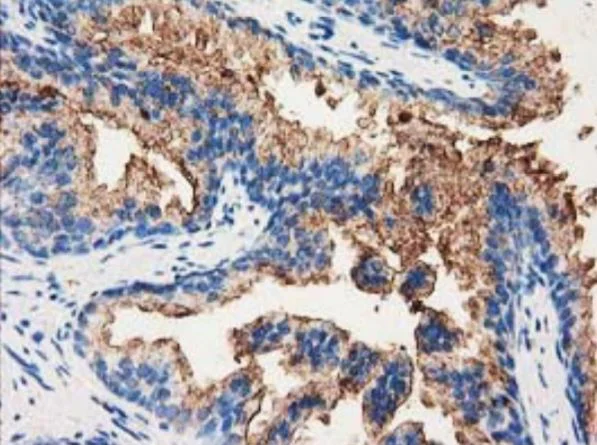 Immunohistochemistry (Formalin/PFA-fixed paraffin-embedded sections) - Anti-Annexin A3/ANXA3 antibody [OTI5G4] - BSA and Azide free (AB273649)