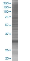 SDS-PAGE - Annexin IV overexpression 293T lysate (whole cell) (AB94081)