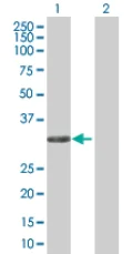 Western blot - Annexin IV overexpression 293T lysate (whole cell) (AB94081)