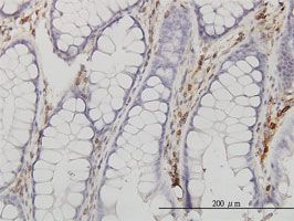 Immunohistochemistry (Formalin/PFA-fixed paraffin-embedded sections) - Anti-Annexin V/ANXA5 antibody [1F4-1A5] (AB54775), expandable thumbnail