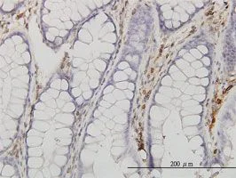 Immunohistochemistry (Formalin/PFA-fixed paraffin-embedded sections) - Anti-Annexin V/ANXA5 antibody [1F4-1A5] (AB54775)