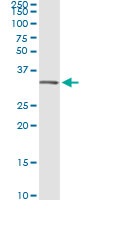 Immunoprecipitation - Anti-Annexin V/ANXA5 antibody [1F4-1A5] (AB54775), expandable thumbnail