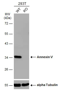 Western blot - Anti-Annexin V/ANXA5 antibody (AB137823)