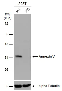 Western blot - Anti-Annexin V/ANXA5 antibody (AB140068)