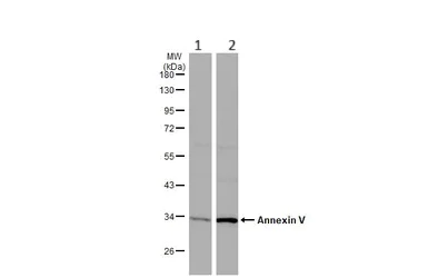 Western blot - Anti-Annexin V/ANXA5 antibody (AB140068)