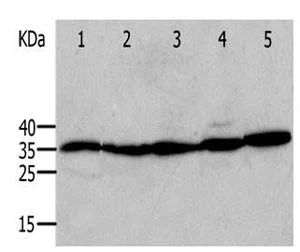 Western blot - Anti-Annexin V/ANXA5 antibody (AB182646)