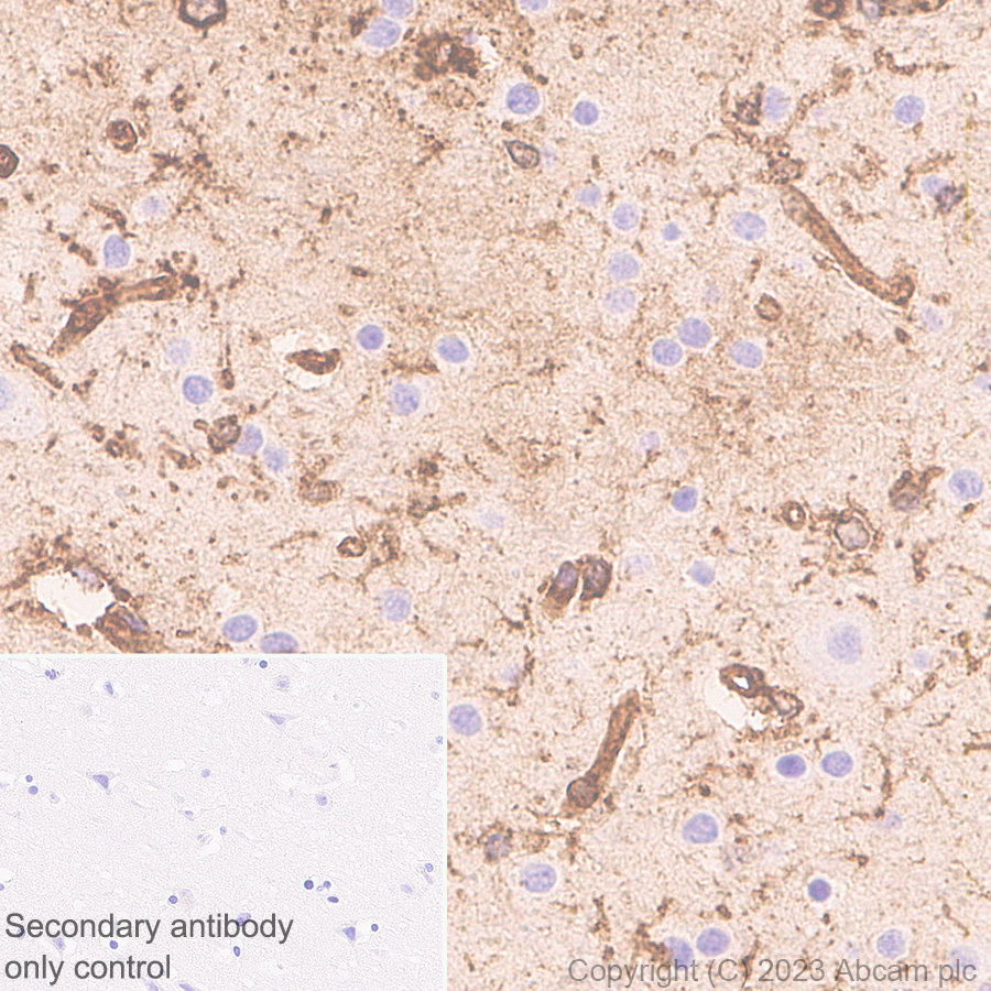 Immunohistochemistry (Formalin/PFA-fixed paraffin-embedded sections) - Anti-Annexin V/ANXA5 antibody [EPR28047-61] (ab313581), expandable thumbnail