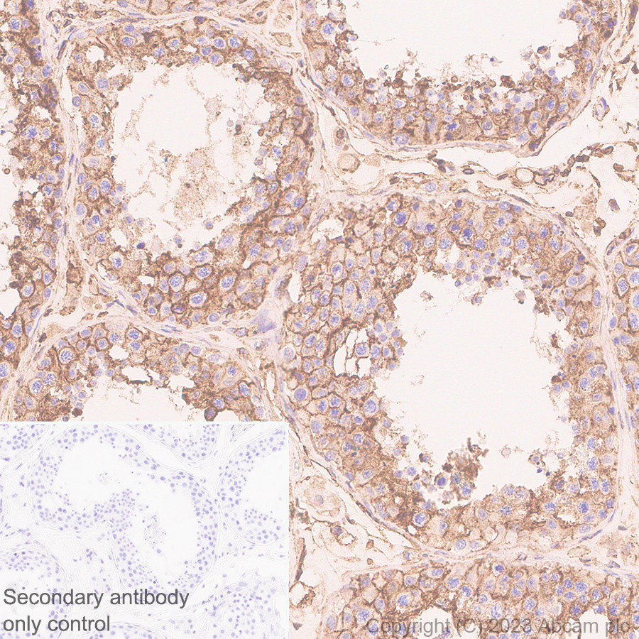 Immunohistochemistry (Formalin/PFA-fixed paraffin-embedded sections) - Anti-Annexin V/ANXA5 antibody [EPR28047-61] (ab313581), expandable thumbnail