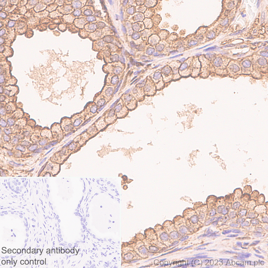 Immunohistochemistry (Formalin/PFA-fixed paraffin-embedded sections) - Anti-Annexin V/ANXA5 antibody [EPR28047-61] (ab313581), expandable thumbnail