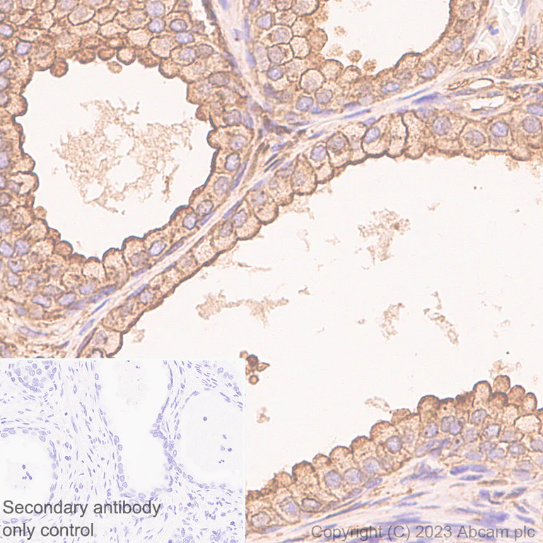 Immunohistochemistry (Formalin/PFA-fixed paraffin-embedded sections) - Anti-Annexin V/ANXA5 antibody [EPR28047-61] (AB313581)