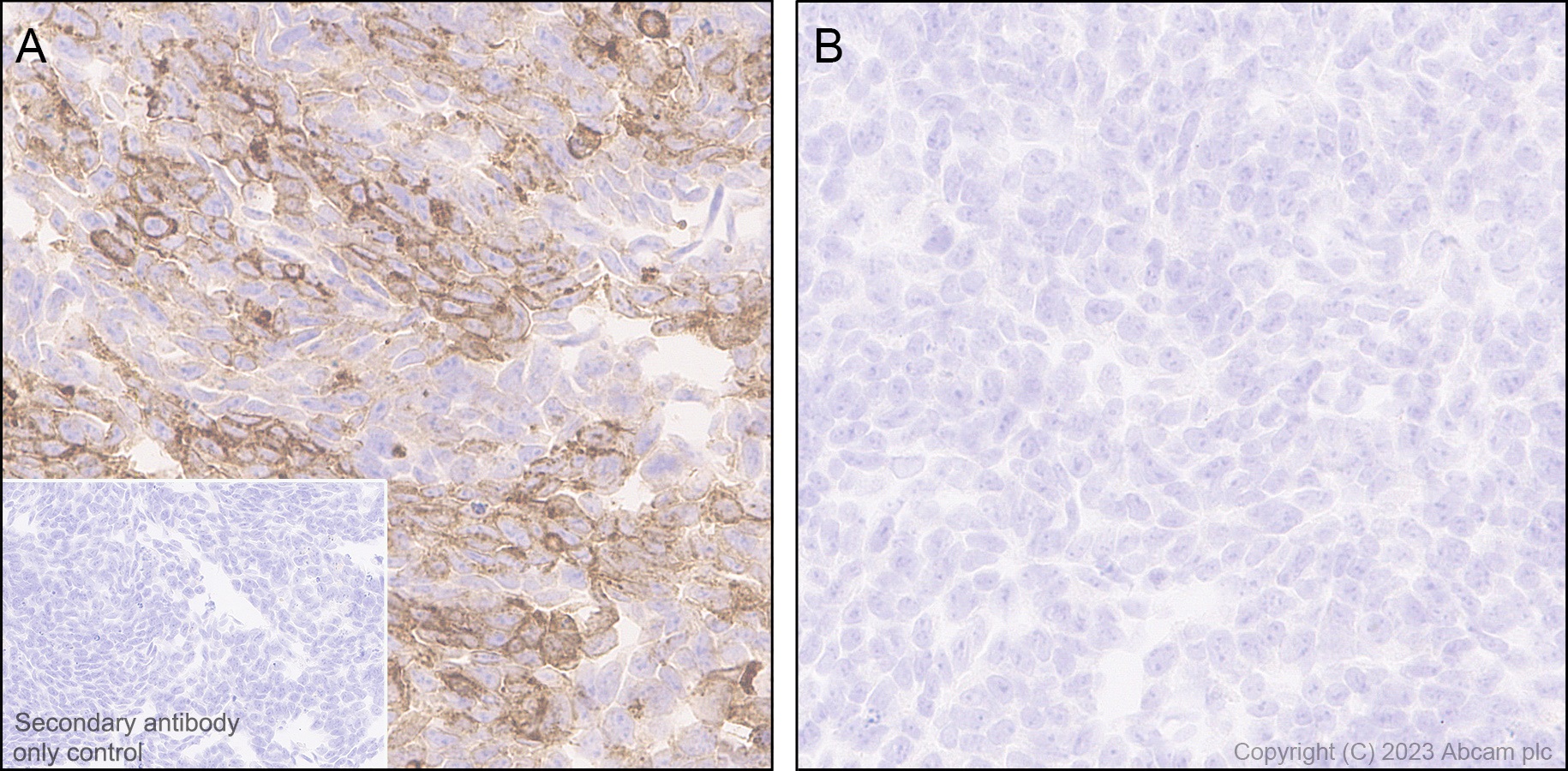 Immunohistochemistry (Formalin/PFA-fixed paraffin-embedded sections) - Anti-Annexin V/ANXA5 antibody [EPR28047-61] (AB313581), expandable thumbnail
