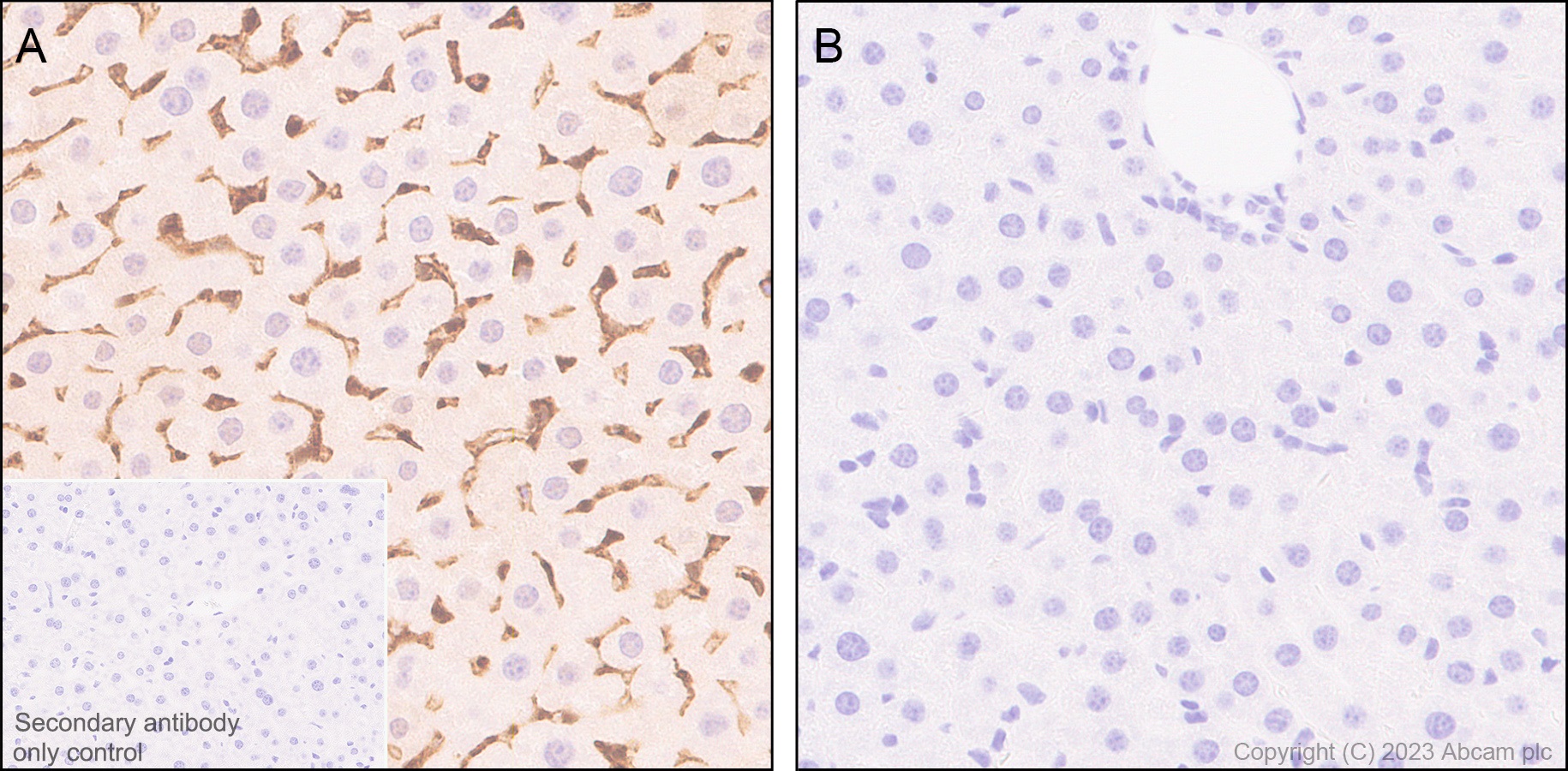 Immunohistochemistry (Formalin/PFA-fixed paraffin-embedded sections) - Anti-Annexin V/ANXA5 antibody [EPR28047-61] (AB313581), expandable thumbnail
