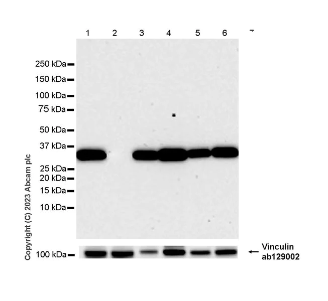 Western blot - Anti-Annexin V/ANXA5 antibody [EPR28047-61] (AB313581)