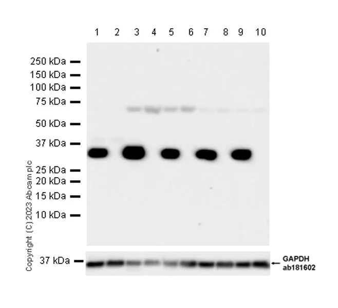 Western blot - Anti-Annexin V/ANXA5 antibody [EPR28047-61] (AB313581)