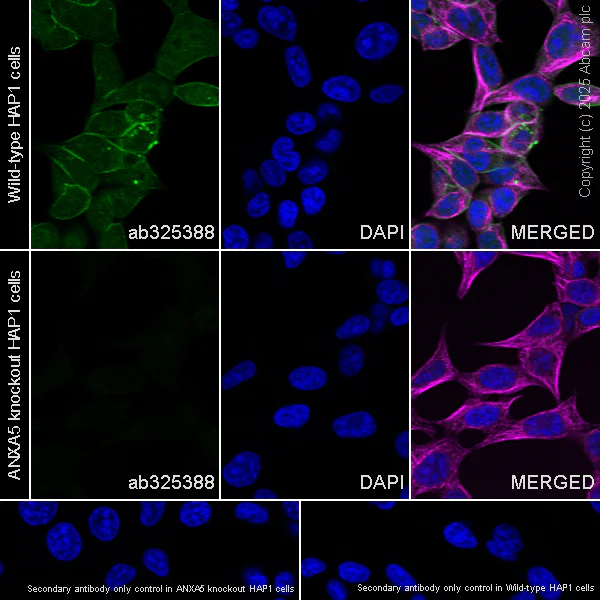 Immunocytochemistry/ Immunofluorescence - Anti-Annexin V/ANXA5 antibody [RM1317] (AB325388)