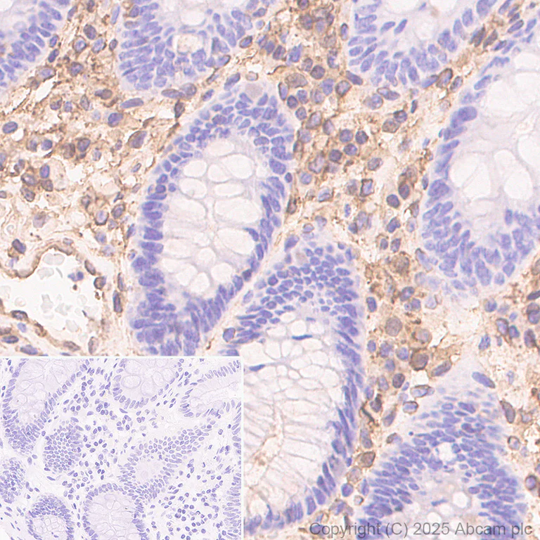 Immunohistochemistry (Formalin/PFA-fixed paraffin-embedded sections) - Anti-Annexin V/ANXA5 antibody [RM1317] (AB325388)