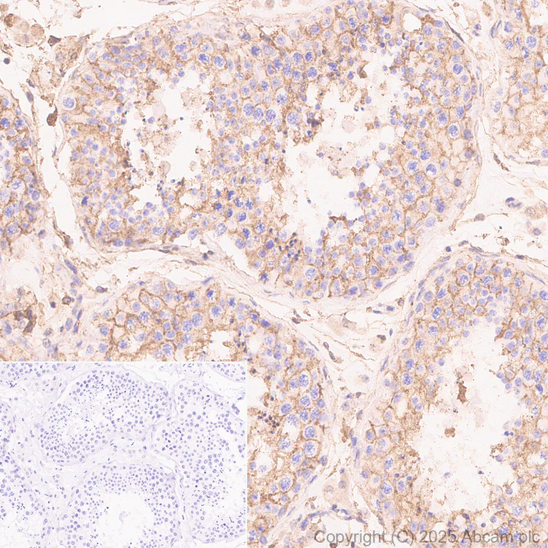 Immunohistochemistry (Formalin/PFA-fixed paraffin-embedded sections) - Anti-Annexin V/ANXA5 antibody [RM1317] (AB325388)
