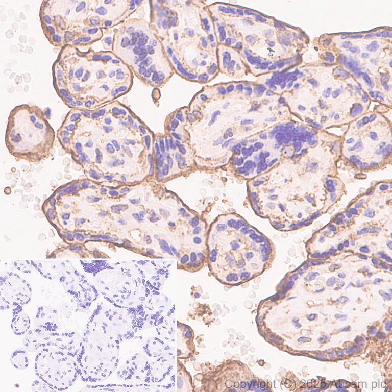 Immunohistochemistry (Formalin/PFA-fixed paraffin-embedded sections) - Anti-Annexin V/ANXA5 antibody [RM1317] (AB325388)