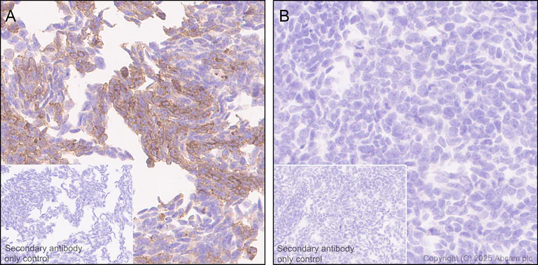 Immunohistochemistry (Formalin/PFA-fixed paraffin-embedded sections) - Anti-Annexin V/ANXA5 antibody [RM1317] (AB325388)