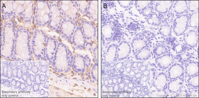 Immunohistochemistry (Formalin/PFA-fixed paraffin-embedded sections) - Anti-Annexin V/ANXA5 antibody [RM1317] (AB325388)