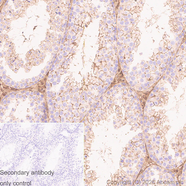 Immunohistochemistry (Formalin/PFA-fixed paraffin-embedded sections) - Anti-Annexin V/ANXA5 antibody [RM1317] (AB325388)