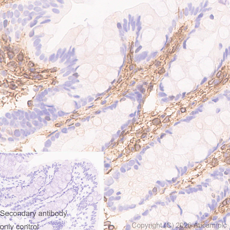 Immunohistochemistry (Formalin/PFA-fixed paraffin-embedded sections) - Anti-Annexin V/ANXA5 antibody [RM1317] (AB325388)