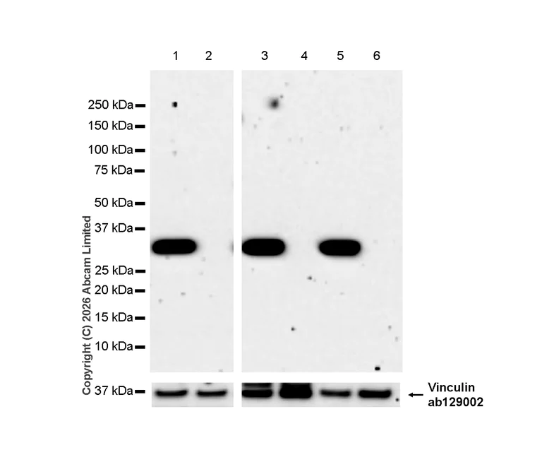 Western blot - Anti-Annexin V/ANXA5 antibody [RM1317] (AB325388)