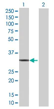Western blot - Annexin V/ANXA5 overexpression 293T lysate (whole cell) (AB76216)